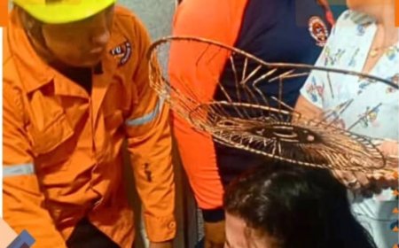 Se le incrustó una rejilla de ventilador en la cabeza