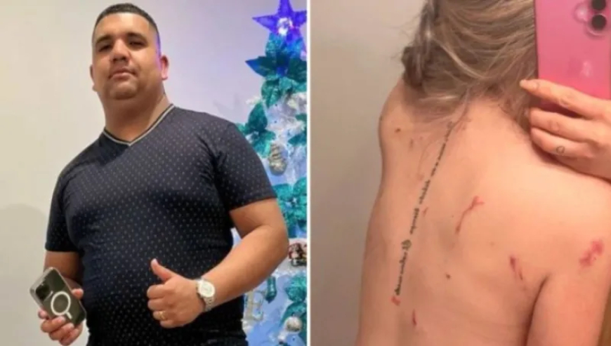 Venezolana sobrevive a 28 puñaladas que le dio su ex pareja frente a sus hijos