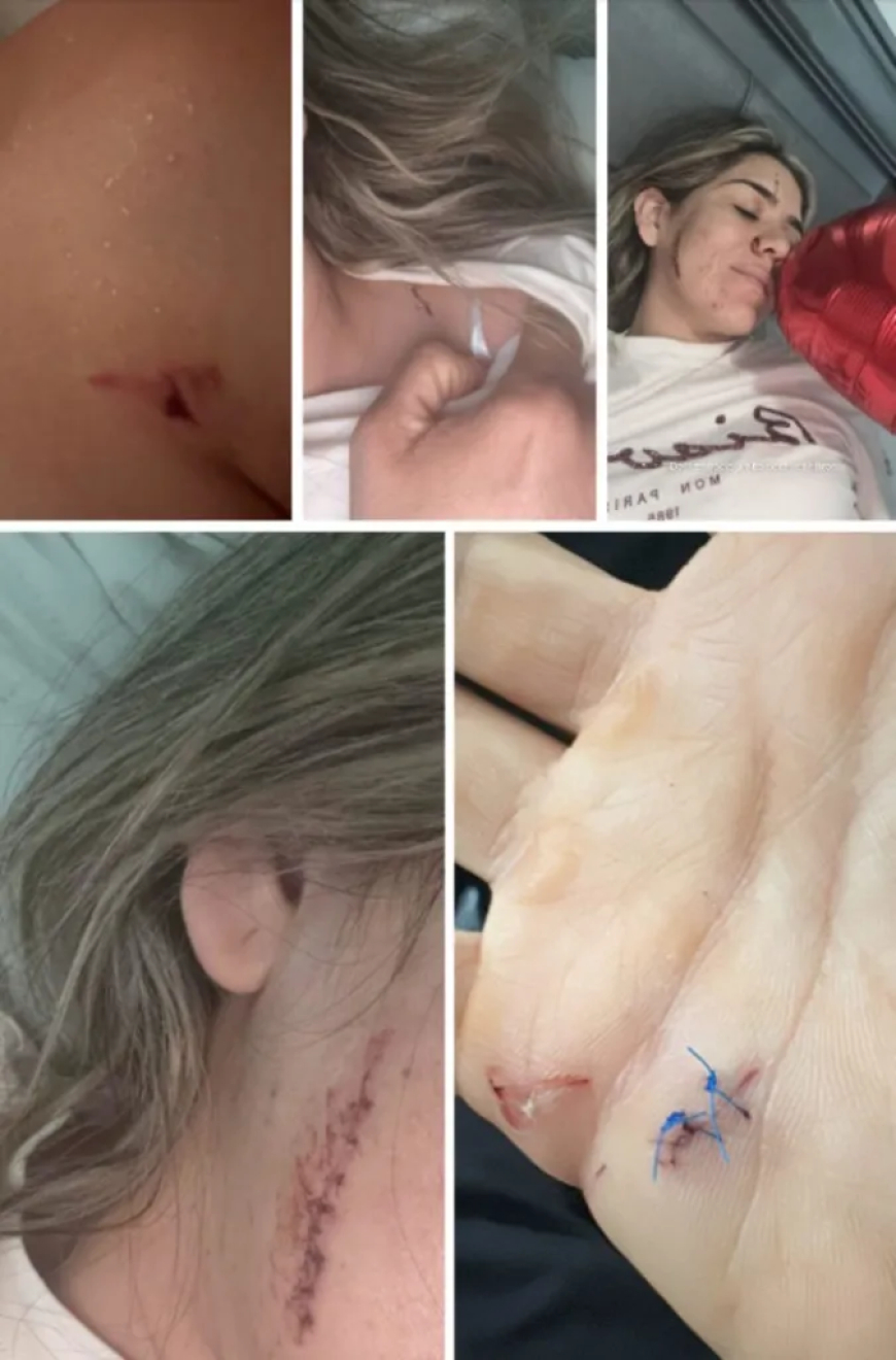 Venezolana sobrevive a 28 puñaladas que le dio su ex pareja frente a sus hijos