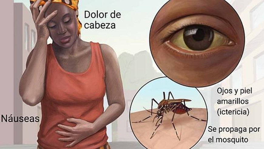 Especialista recomienda mantener vigilancia epidemiológica para evitar contagios en Venezuela