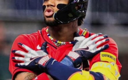 Molestia en espalda de Acuña no es mucha preocupación, pero debe vigilarse más