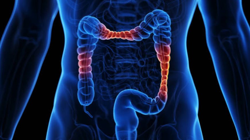 Sin atención a tiempo, la diverticulitis puede generar una peritonitis