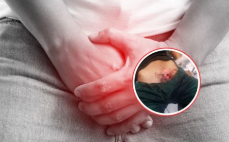 Emborrachó y le cortó el miembro a su marido por infiel