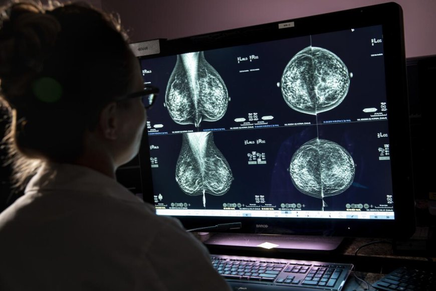 Mamografía detecta lesiones de 0,5 cm para diagnóstico precoz