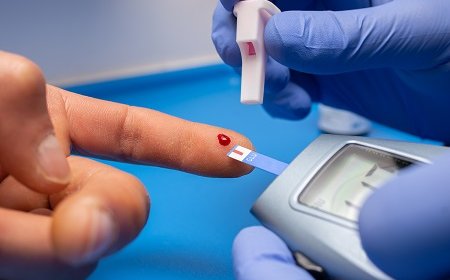 Diabetes: La medición de la glicemia es la principal defensa contra las complicaciones