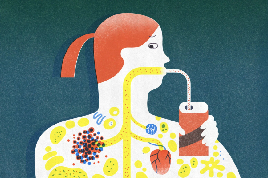 ¿El azúcar alimenta las células cancerosas?