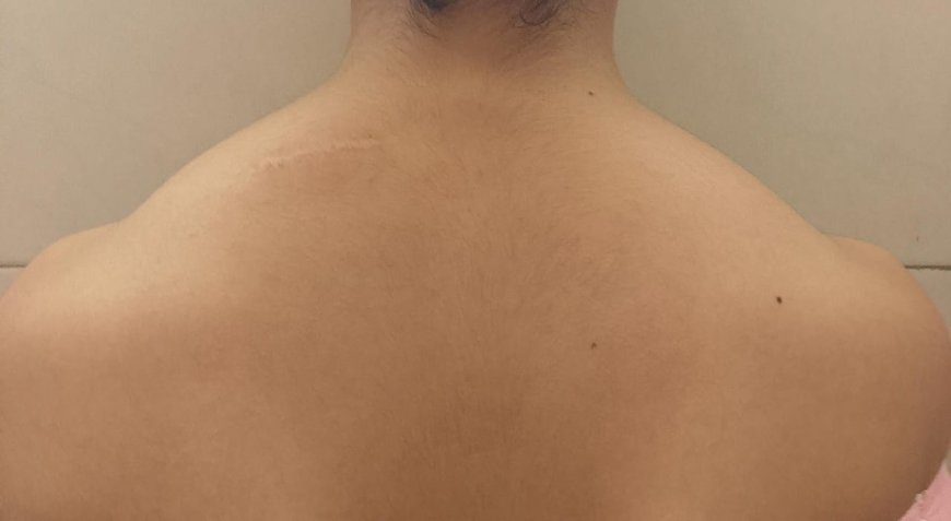 La ozonoterapia marca nuevas evidencias positivas