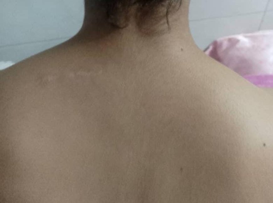 La ozonoterapia marca nuevas evidencias positivas