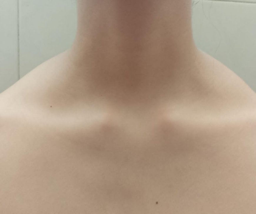 La ozonoterapia marca nuevas evidencias positivas