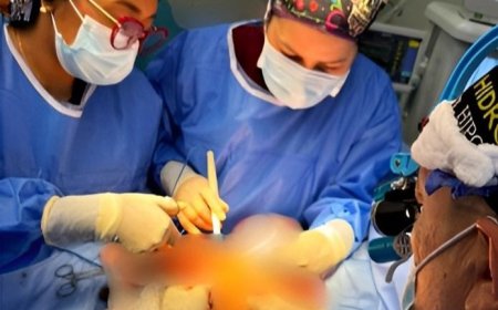 SAHUM: Un éxito cirugía compleja de Síndrome de Prune Belly en paciente pediátrico