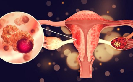 Pasos clave tras detectar VPH: hoja de ruta para proteger la salud femenina