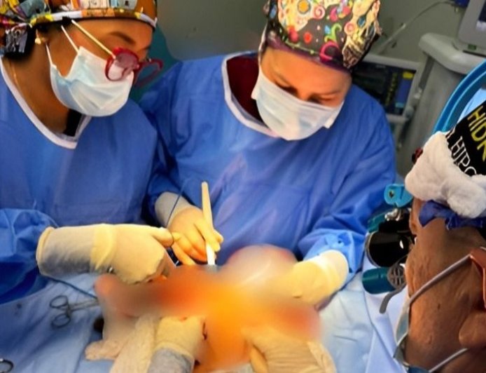 SAHUM: Un éxito cirugía compleja de Síndrome de Prune Belly en paciente pediátrico