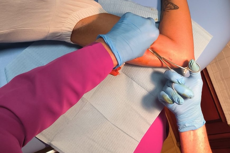 Implante subdérmico anticonceptivo para fortalecer la planificación juvenil