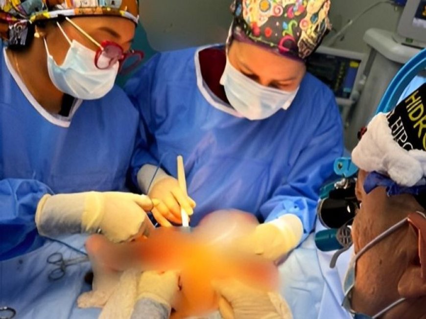 SAHUM: Un éxito cirugía compleja de Síndrome de Prune Belly en paciente pediátrico