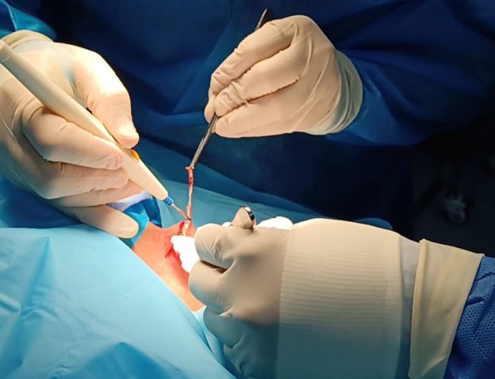 Jornada de marcasos en el SeAHUM fortalece la salud cardiológica en el Zulia