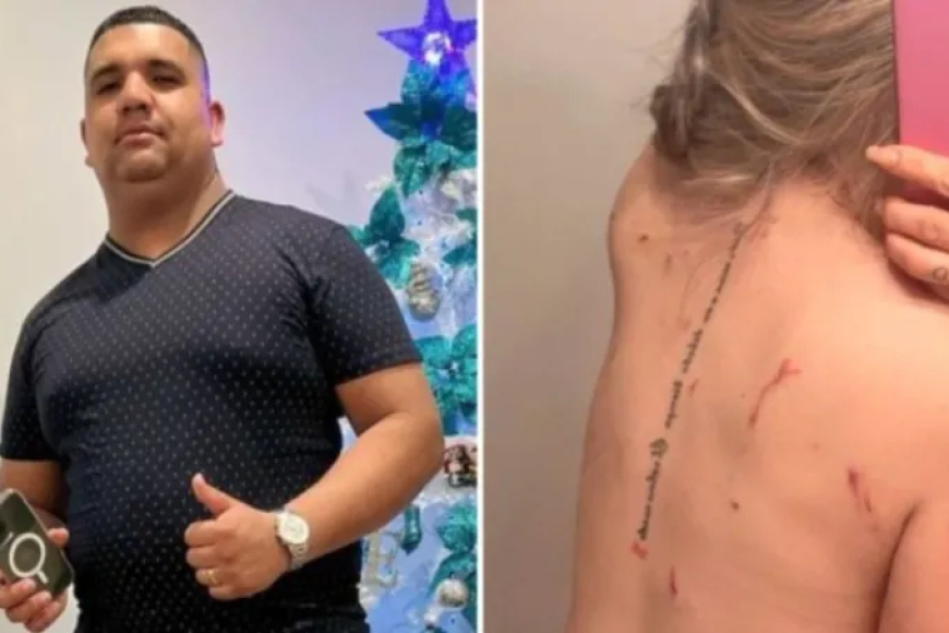 Venezolana sobrevive a 28 puñaladas que le dio su ex pareja frente a sus hijos