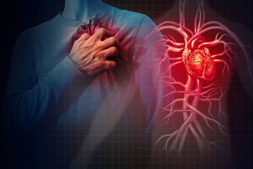 Infarto al miocardio: Carrera contra reloj y la vital importancia de la Hemodinamia
