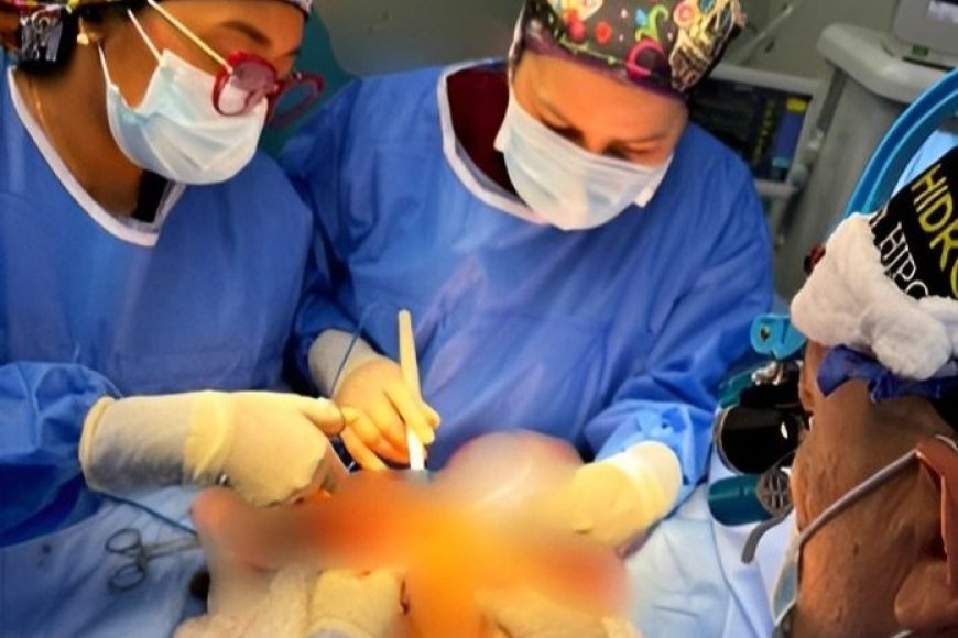 SAHUM: Un éxito cirugía compleja de Síndrome de Prune Belly en paciente pediátrico