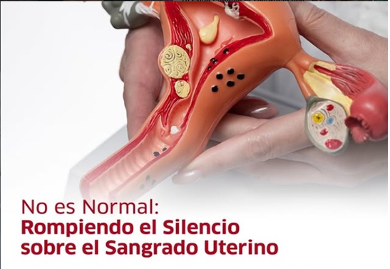 Sangrado uterino anormal afecta al 30% de las mujeres