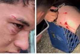 Herido menor de edad tras una tángana en vacacional de fútbol en Barinas