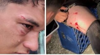 Herido menor de edad tras una tángana en vacacional de fútbol en Barinas