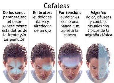 Identificar desencadenantes y evitar la automedicación permite controlar las crisis de migraña